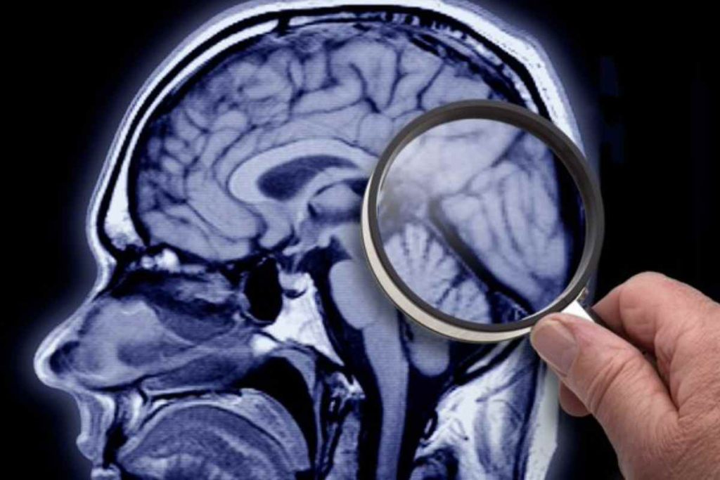 Un ragazzo sconfigge definitivamente il suo tumore al cervello dopo sette anni dalla diagnosi iniziale.