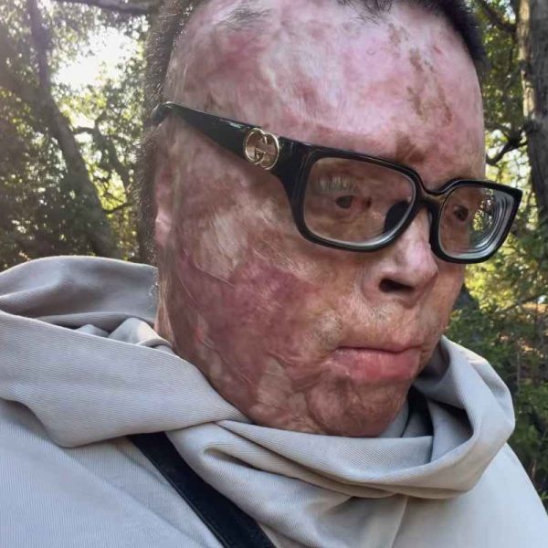 «La mia vita fa schifo e non voglio più andare avanti»: chi è Him6kardashian, youtuber che ha commosso il web?