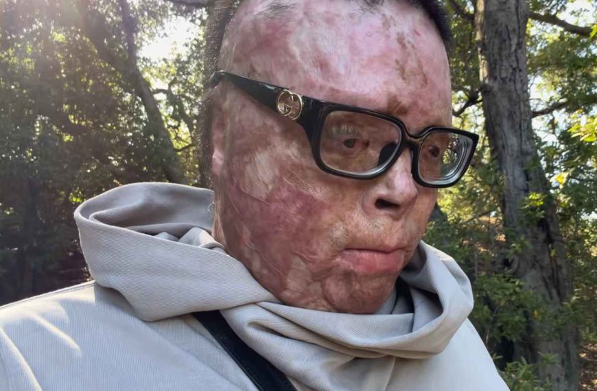 «La mia vita fa schifo e non voglio più andare avanti»: chi è Him6kardashian, youtuber che ha commosso il web?